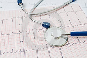 EKG / ECG chart and stethoscope photo