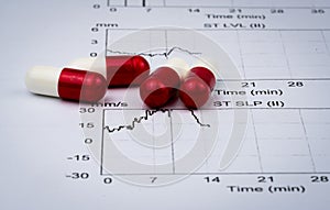 EKG or ECG Electrocardiogram graph report paper. EST Exercise Stress Test result and red-white capsule pills. Package promot