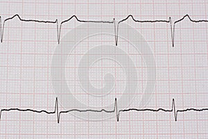 ekg/ ecg - medical background