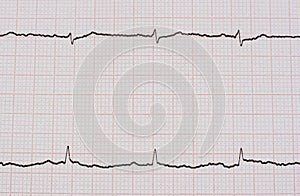 Ekg/ ecg - medical background