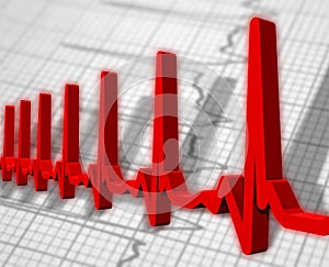 Ekg/ecg pulse diagram