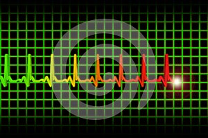 Ekg/ecg pulse diagram header