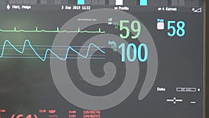 EKG heart monitor