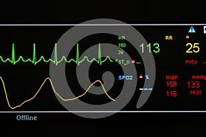 EKG monitor in ICU unit