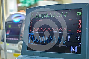 EKG monitor in intra aortic balloon pump machine.