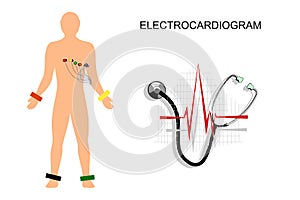 EKG, the patient with the electrodes on the chest.