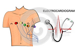 EKG, the patient with the electrodes on the chest. photo
