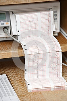 EKG Print out