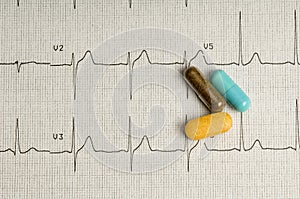 EKG printout