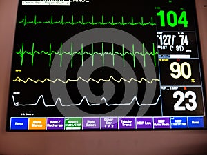 EKG, Pulse, BP and Respiration ICU Monitor Screen