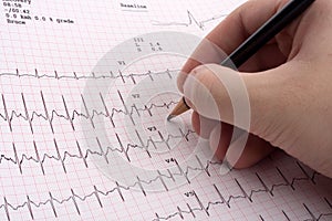 EKG results photo