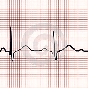 EKG seamless vector pattern