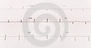 EKG With Selective Focus