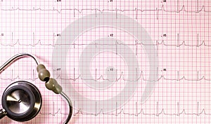 EKG with stethoscope