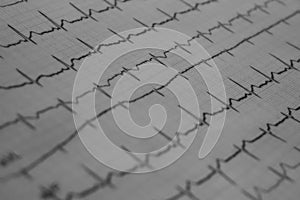 EKG von einem Kardiologen photo