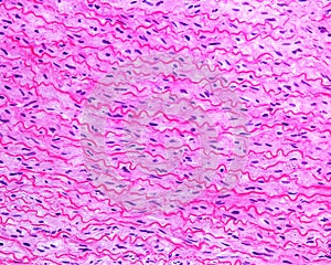 Small intestine. Paneth cells photo