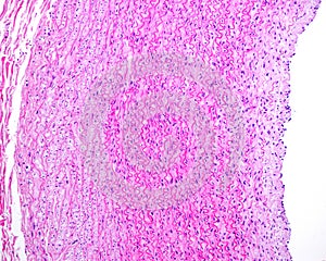 Small intestine. Paneth cells photo