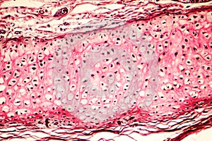 Elastic cartilage of human outer ear