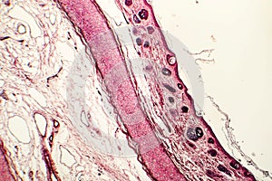 Elastic cartilage of human outer ear photo