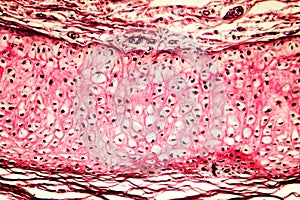 Elastic cartilage of human outer ear photo