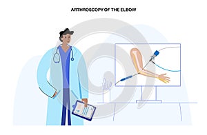 Elbow arthroscopy surgery