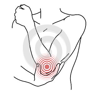 Elbow pain location. Bursitis of arm joint  dislocated  sprain  arthritis  arthrosis  epicondylitis