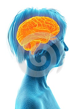 An elder females brain photo