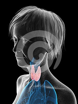 An elder females thyroid