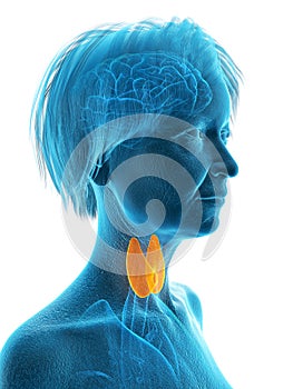 An elder females thyroid gland