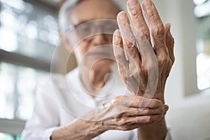 Elderly female patient suffer from numbing pain in hand,numbness fingertip,arthritis inflammation,beriberi or peripheral