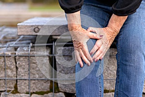 Elderly lady grabbing her knee in pain