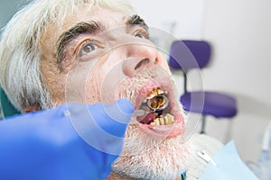 Elderly man with bad teeth.