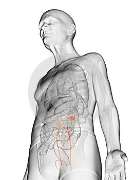 An elderly mans ureters photo