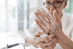 elderly scratch her hands,dry skin (Xerosis),Dermatitis,itchy skin on the back of hands,contact with irritants or