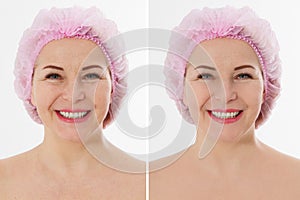 Before-after elderly skin. Before after closeup Beauty middle age woman face portrait. Spa anti aging concept Isolated on white