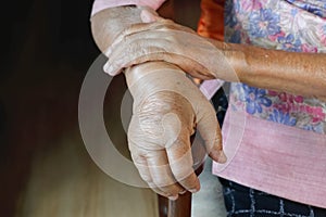 Elderly swollen hand or edema hand