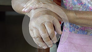 Elderly swollen hand or edema hand