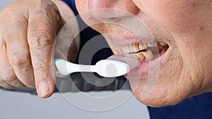 Elderly tooth attrition