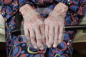 Elderly woman of 90 years put her hands on a cane, retirement and disability, close up.Elderly people are susceptible to the virus