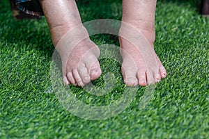 Elderly woman bare swollen feet on grass photo