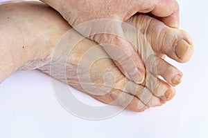 Elderly woman has pain in the feet and toes