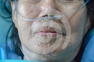 Elderly woman with nasal breathing tube