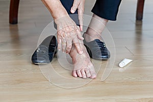 Elderly woman putting cream on swollen feet