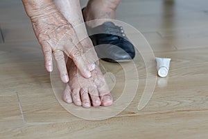 Elderly woman putting cream on swollen feet