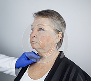 An elderly woman at the reception of a facial plastic surgeon. Consultation on the removal of age wrinkles on the face. The doctor