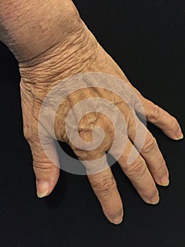 Elderly woman`s bare left hand