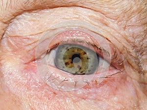 Elderly woman`s grey hazel eye with visible nerve rings.