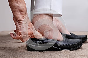 Elderly woman swollen feet putting on shoes