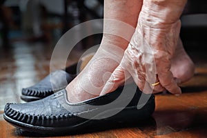 Elderly woman swollen feet putting on shoes photo