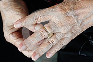Elderly woman try to remove stuck ring off a swollen finger photo